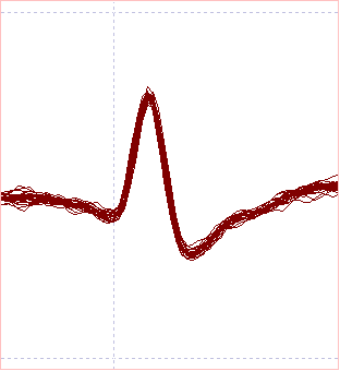 Template scope view error 12